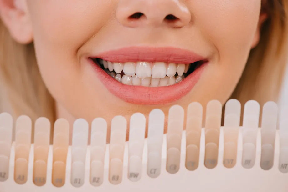 Blanqueamiento Dental